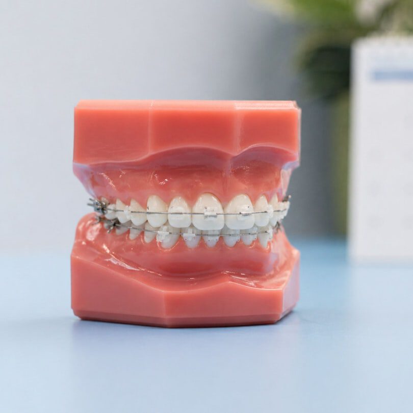 A dental braces display model on a light blue clinic counter, showing teeth, gums, wires and orthodontic details with soft shadows and reflections.